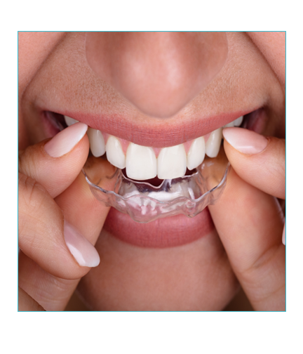 Invisalign ottawa dentist