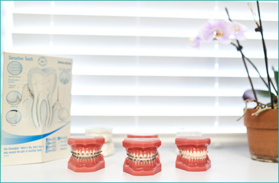 Early Ortho Treatment ottawa dentist