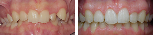 ottawa orthodontics