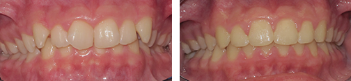 ottawa orthodontics