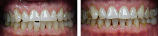 ottawa orthodontics