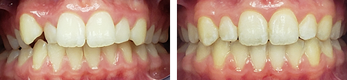 ottawa orthodontics