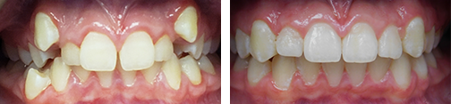 ottawa orthodontics