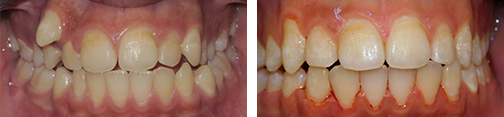 ottawa orthodontics