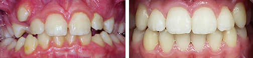 orthodontics