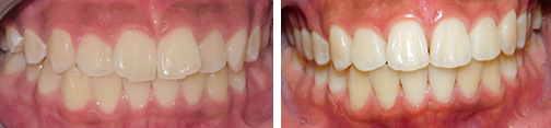 ottawa orthodontics