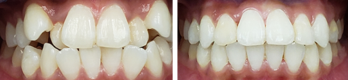 orthodontics