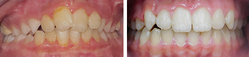 ottawa orthodontics
