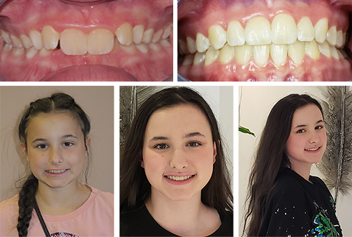 ottawa orthodontics