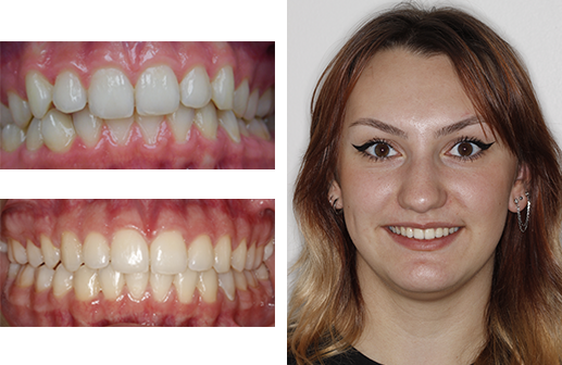 ottawa orthodontics